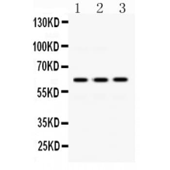 Polyclonal Rabbit anti-Human EME1 Antibody (aa520-561, IHC, WB)