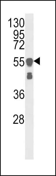 Vimentin Antibody