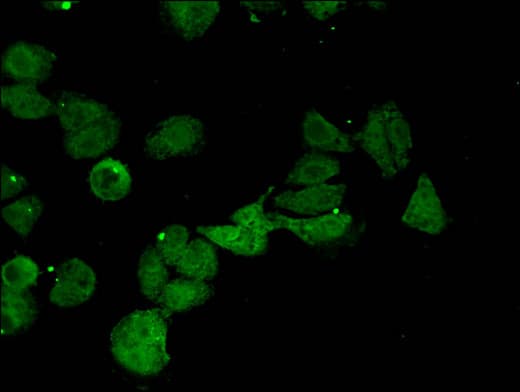 CTH / Cystathionase Antibody
