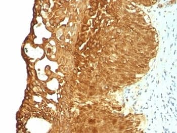 KRT19 / CK19 / Cytokeratin 19 Antibody (clone KRT19/799)