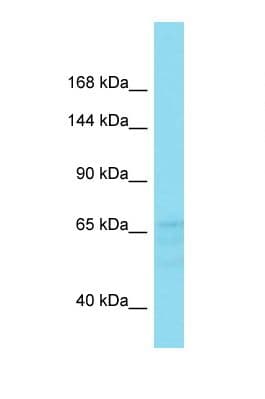 Polyclonal Rabbit anti-Human FAM47B Antibody (C-Terminus, WB)