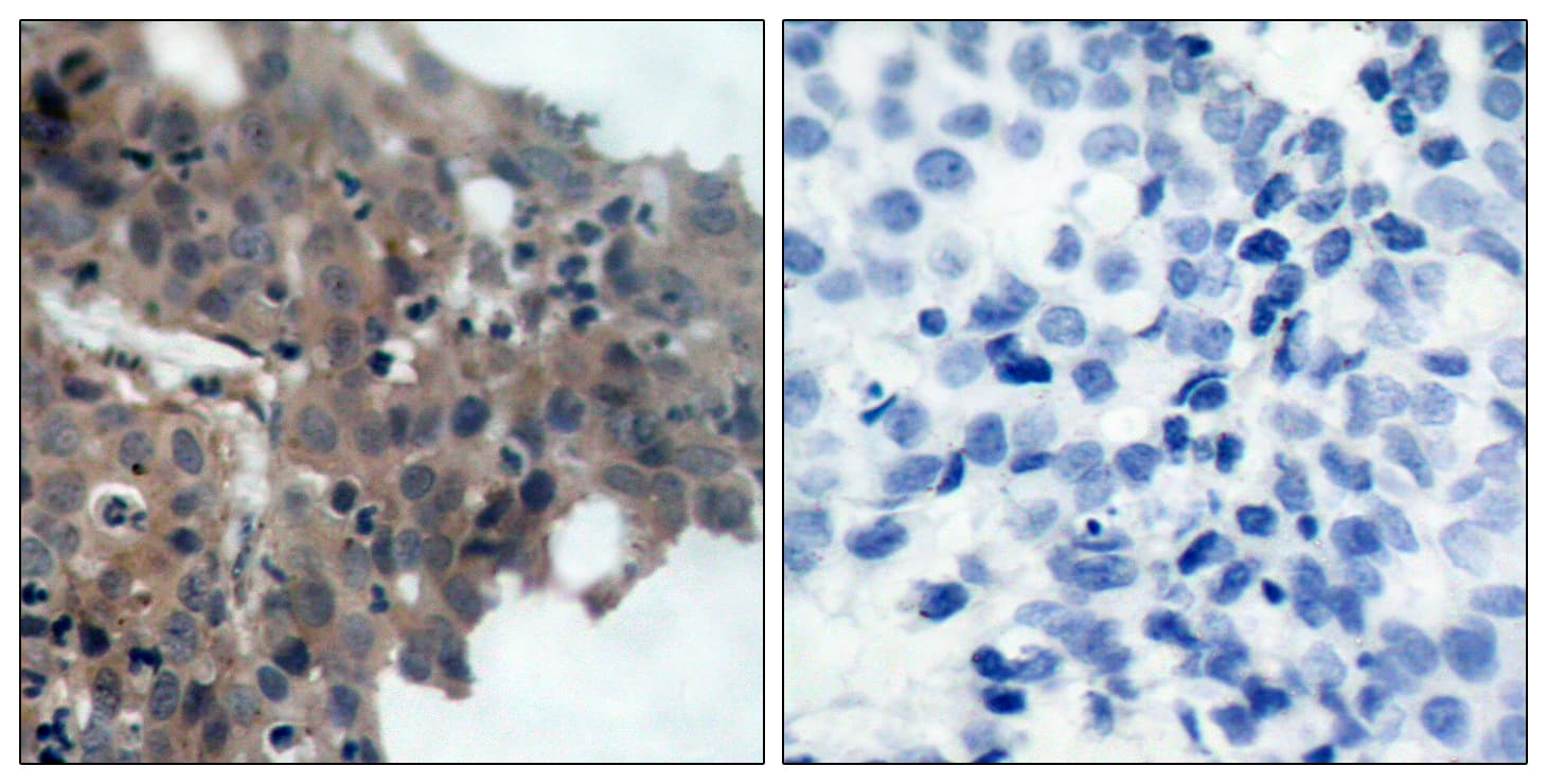 Polyclonal Rabbit anti-Human CDKN1A / WAF1 / p21 Antibody (phospho-Thr145, IHC, WB)