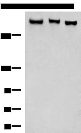 ABP-280 / FLNC Antibody