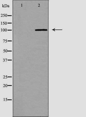 Polyclonal Rabbit anti-Human LIG4 / DNA Ligase IV Antibody (IHC, IF, WB)