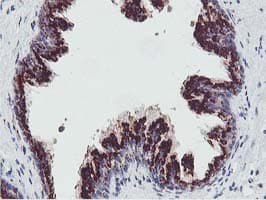 GOLM1 / GP73 / GOLPH2 Antibody (clone OTI4B12)