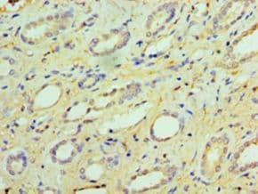 Polyclonal Rabbit anti-Human GUCA2B / Uroguanylin Antibody (aa37-112, IHC)