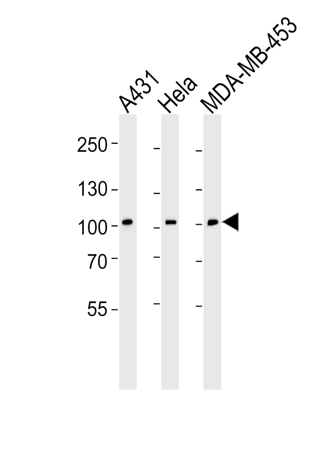 EPHB1 / EPH Receptor B1 Antibody (aa955-984)