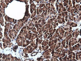 PIK3C2B Antibody (clone OTI3B1)