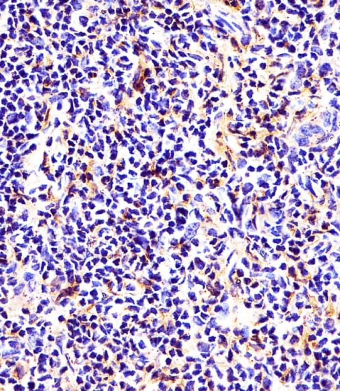 Polyclonal Rabbit anti-Human Tubulin beta-5 chain Antibody (IHC, IF, WB)