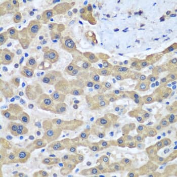 Polyclonal Rabbit anti-Human GFM1 Antibody (IHC, WB)