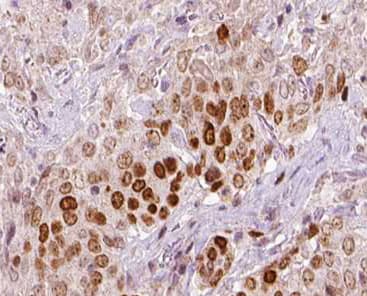 REV3L / REV3 Antibody