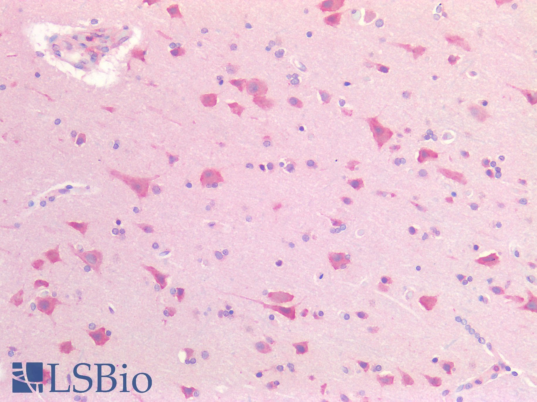 IHC-plus™ Polyclonal Rabbit anti-Human ACHE / Acetylcholinesterase Antibody (IHC)