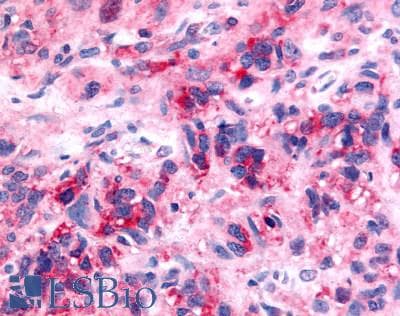 PathPlus™ NTSR2 / NTR2 Antibody (Extracellular Domain)