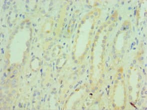 Polyclonal Rabbit anti-Human TNXB / Tenascin XB Antibody (aa3933-4242, IHC)