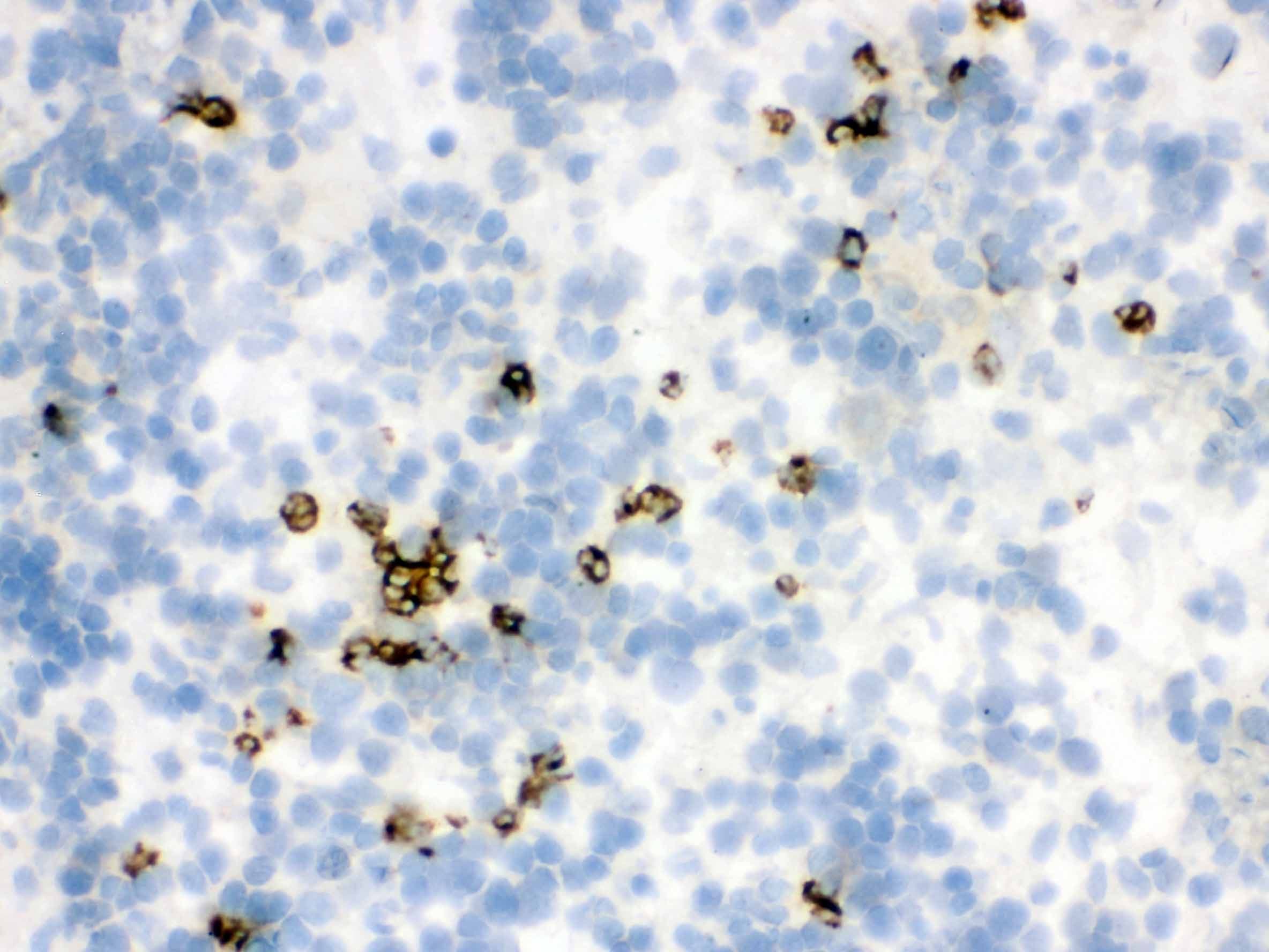 Polyclonal Rabbit anti-Rat LCN2 / Lipocalin 2 / NGAL Antibody (aa21-198, IHC, WB)