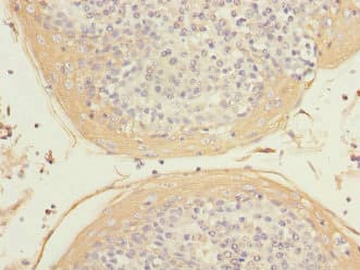 HIST1H3A Antibody