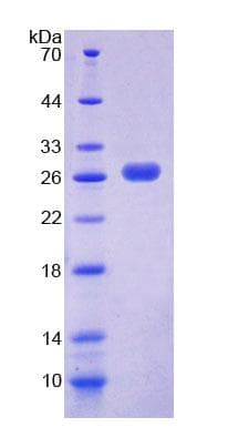 Mouse PEX1 Protein (Recombinant His-T7)