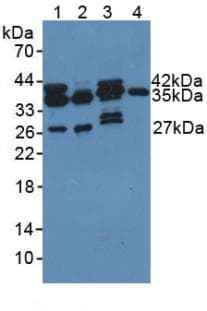 PDXK / PNK Antibody (aa35-251)
