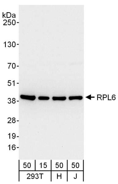 Polyclonal Rabbit anti-Human RPL6 / Ribosomal Protein L6 Antibody (aa25-75, IHC, WB)