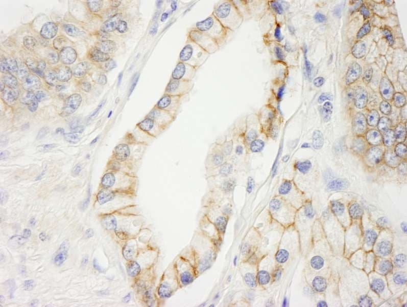 KIAA0528 Antibody (aa375-425)