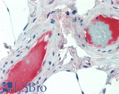 Monoclonal Mouse anti-Human CP / Ceruloplasmin Antibody (aa789-1065, IHC, WB)