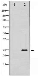 Polyclonal Rabbit anti-Human TK1 / TK / Thymidine Kinase Antibody (IHC, IF, WB)
