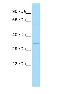 Polyclonal Rabbit anti-Human PHOSPHO1 Antibody (C-Terminus, WB)