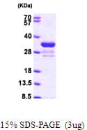 Human RAD1 Protein (Recombinant His)
