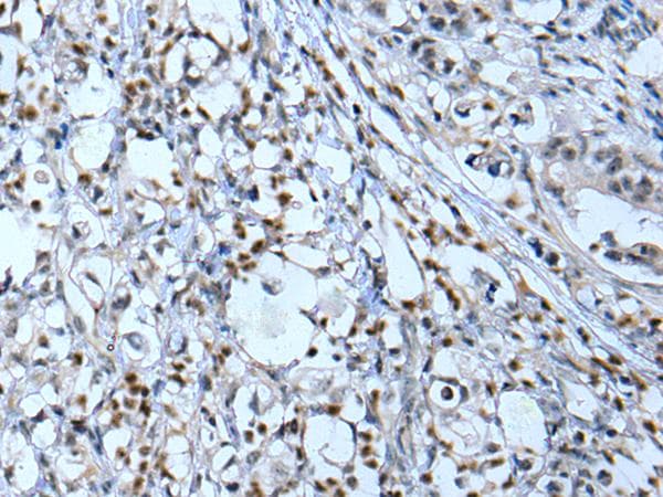 Polyclonal Rabbit anti-Human Neurofibromin / NF1 Antibody (IHC)