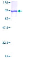 Human ALDH6A1 Protein (Recombinant GST)