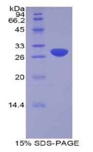 Human ADAM20 Protein (Recombinant His)