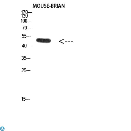 E2F1 Antibody