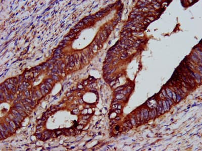 PTP4A2 / PRL-2 Antibody