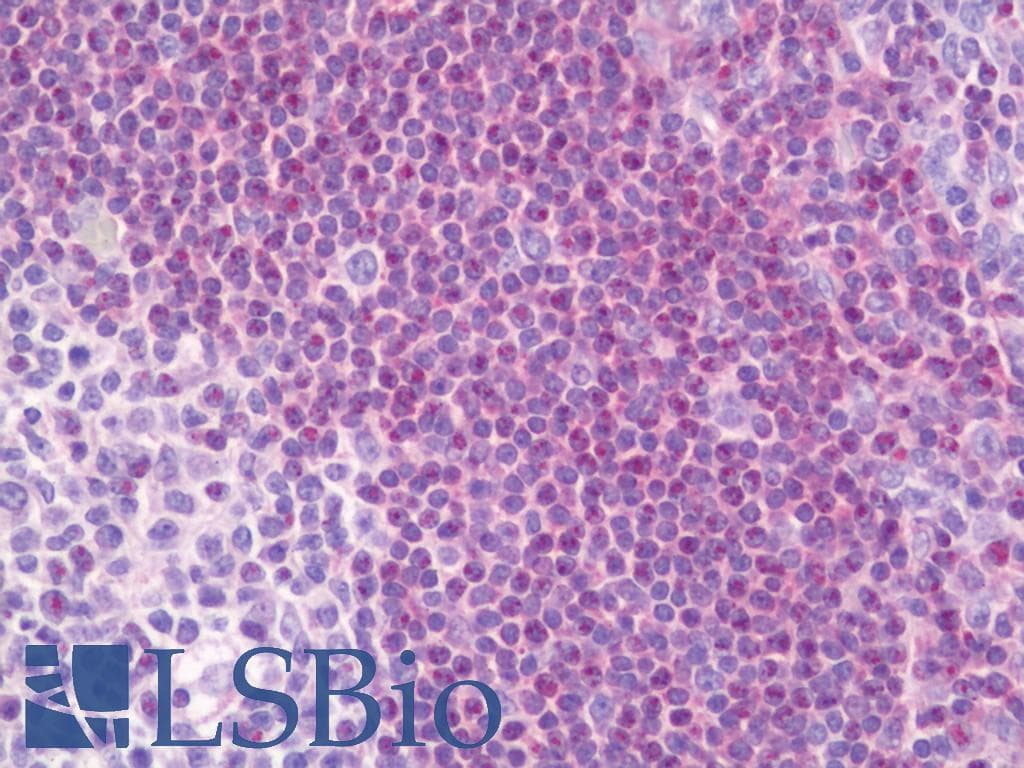 IHC-plus™ PRKCB / PKC-Beta Antibody (aa606-655)
