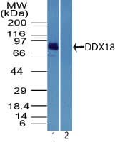 IHC-plus™ DDX18 Antibody (aa20-70)