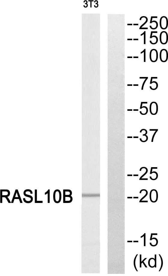 Polyclonal Rabbit anti-Human RASL10B Antibody (WB)