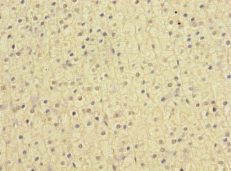 Polyclonal Rabbit anti-Human NISCH Antibody (IHC)