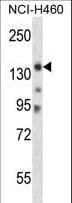 Polyclonal Rabbit anti-Mouse MYO3B Antibody (aa300-329, WB)