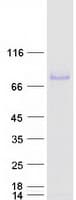 Human PROS1 / Protein S (Recombinant Myc-DDK (Flag))