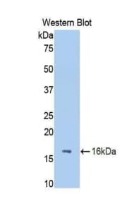 FETUB / Fetuin B Antibody (aa28-141, Biotin)