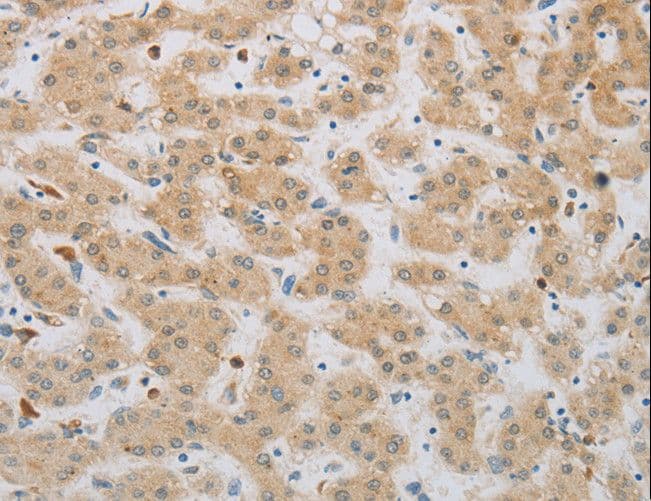 NBN / Nibrin Antibody