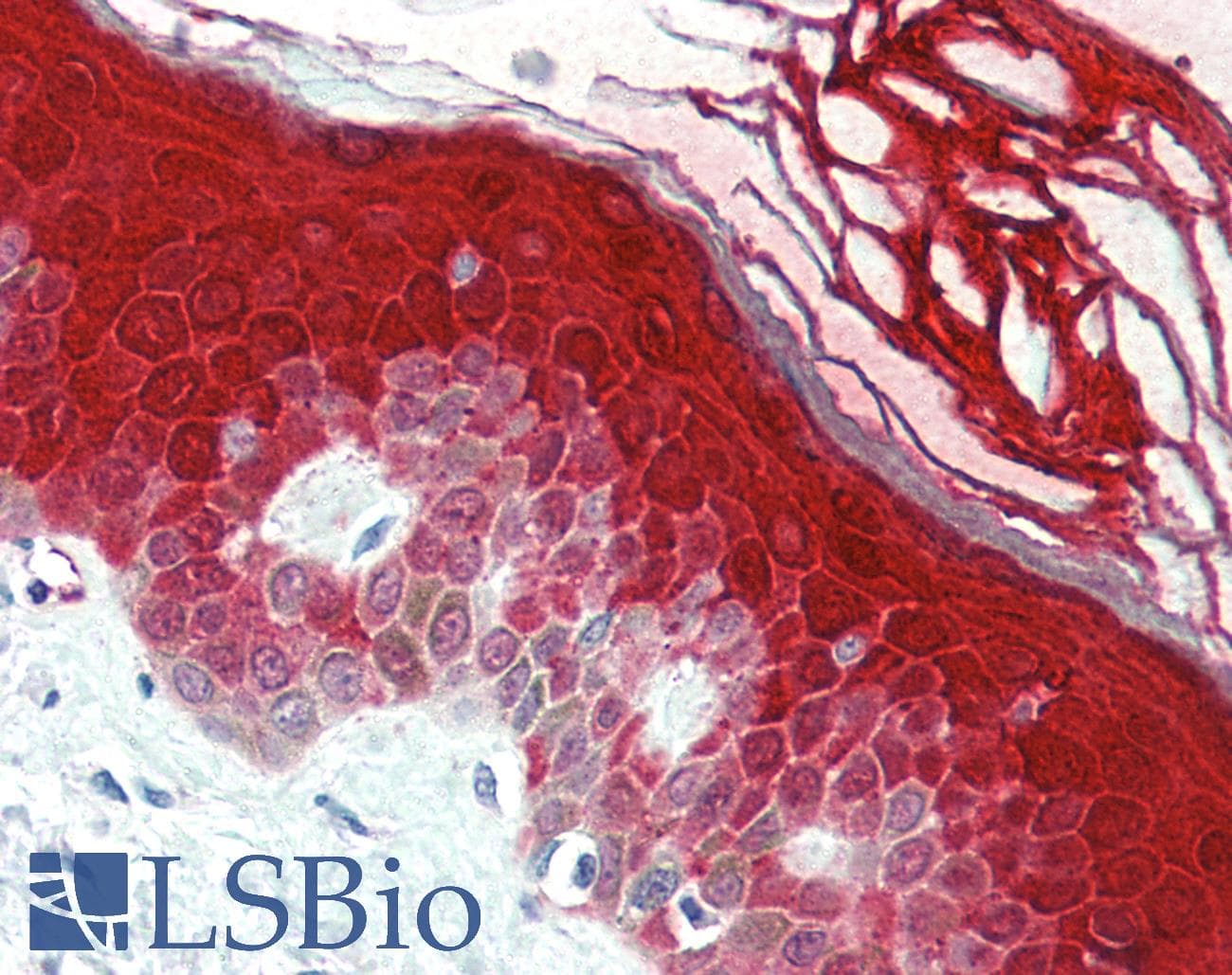 IHC-plus™ CASP14 / Caspase 14 Antibody