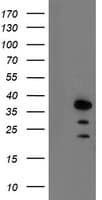 ARA9 / AIP Antibody (clone OTI1B6)