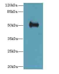 Polyclonal Rabbit anti-Human IFI44 Antibody (IHC, WB)