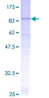 Human SLC22A17 Protein (Recombinant GST)
