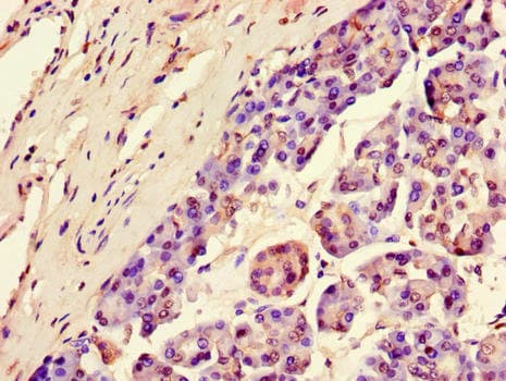 SGK1 / SGK Antibody
