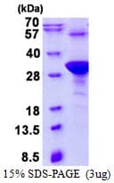 Human HAND1 Protein (Recombinant His)