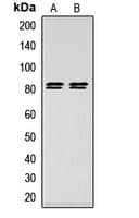 Polyclonal Rabbit anti-Human LIPE / HSL Antibody (phospho-Ser552, IHC, WB)