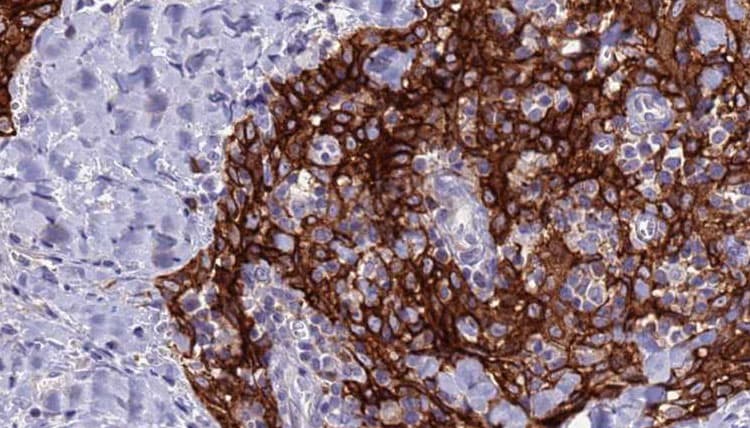 SLC4A9 / AE4 Antibody