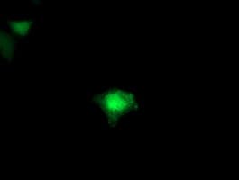 Monoclonal Mouse anti-Human FDFT1 / Squalene Synthase Antibody (clone OTI2F10, IHC, IF, WB)